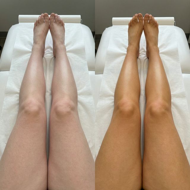 Before/After spray tan — gambe